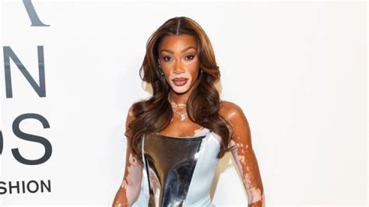 Winnie Harlow net worth